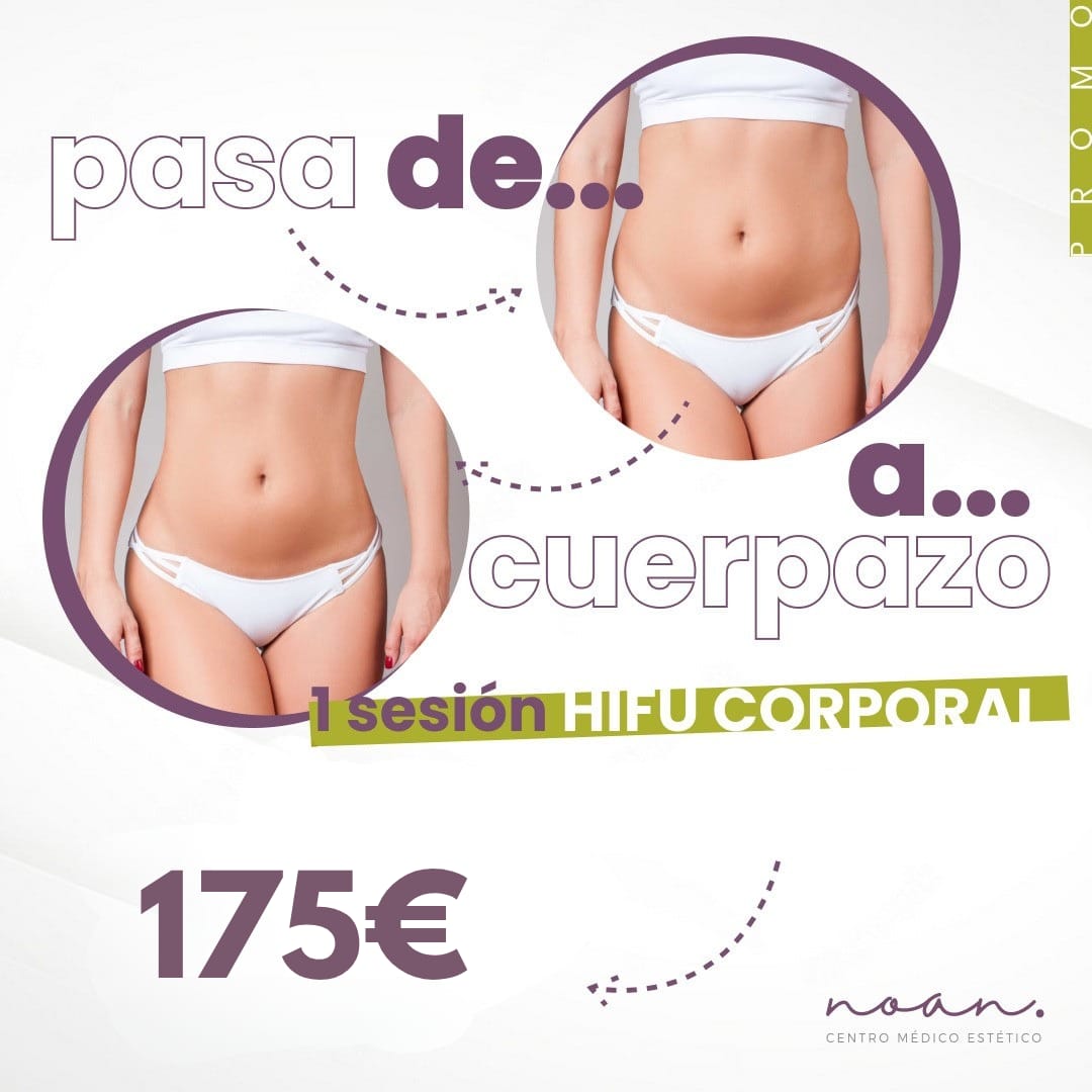 Promoción de una sesión de HIFU corporal por 175€, solo en Agosto